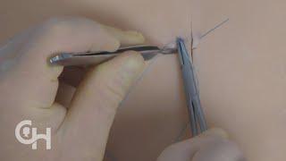 Suture Basics: Vertical Mattress