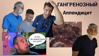 Гангренозный аппендицит.