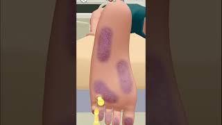 Mr.Doctor Surgery |Surgeon Simulator Doctor Game #Short #Short