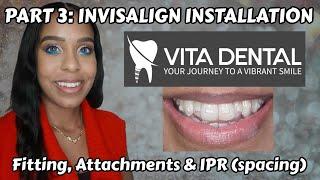 PART 3: I HAD MY INVISALIGN TRAYS PUT ON WITH DR A @ VITA DENTAL (Fitting, Attachments & IPR)