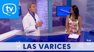 MedicinaTV - 25. Las varices