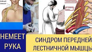 если не получается вылечить синдром передней лестничной мышцы ?