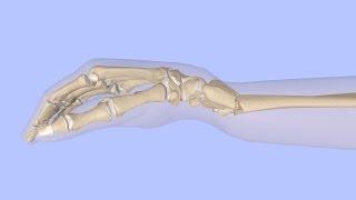 Closed Reduction of a Distal Radius Fracture