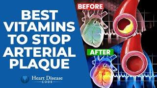 Best Vitamins To Stop Calcium Plaque In Your Arteries And Heart