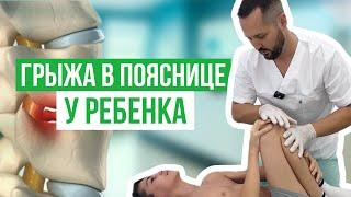 Лечение грыжи в поясничном отделе у ребенка / детский невролог