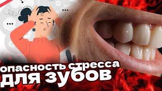 Могут ли болеть зубы от стресса? Зубы и стресс тесно связаны...