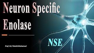 Neuron-specific enolase (NSE) test made easy