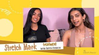 STRETCH MARK TREATMENT WITH ARPITAL CHAWLAA