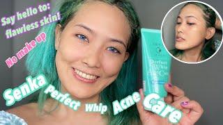 Senka Perfect Whip Acne Care for acne-prone & sensitive skin| Coco Manuel