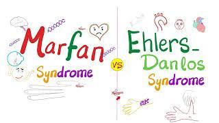 Marfan Syndrome vs. Ehlers-Danlos Syndrome - Biochemistry and Genetics