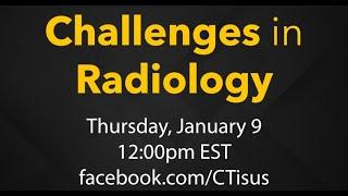 Challenges in Radiology