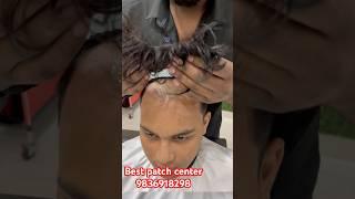 Best frontline patch mens. Best hair wig centre in Kolkata. Best hair cutting salon in Kolkata