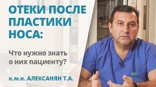 Отеки после ринопластики: сколько держатся, когда проходят и как ускорить рассасывание