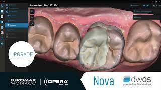  UPGRADE Nova   DWOS by Dental Wings