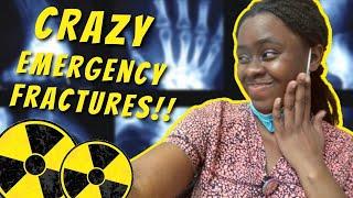 these are some interesting, CRAZY emergency x-rays !!  || Ask The Rad Tech