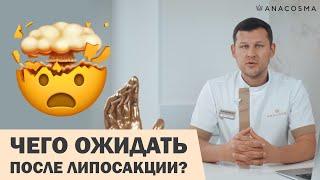 РЕАБИЛИТАЦИЯ ПОСЛЕ ЛИПОСАКЦИИ: К ЧЕМУ ГОТОВИТЬСЯ⁉️