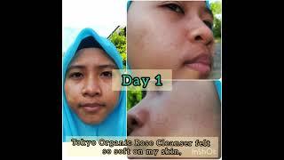 Testimony before & after using  Tokyo Organic skincare  (plus WRONG product)