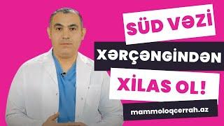 Süd Vəzi Xərçəngindən tamamilə sağalmaq mümkündür? I Dr. Vüqar Mahmudov  #shorts