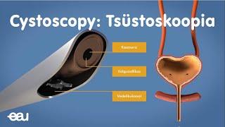 Tsüstoskoopia