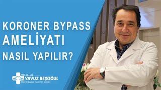 Koroner Bypass Nasıl Yapılır? | Kalp ve Damar Cerrahisi - Prof. Dr. Yavuz Beşoğul