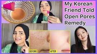 Best Open Pores Korean Remedy By My Korean Friend | Get A Rid Of Open Pores At Home | Dietitian Aqsa