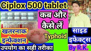 ciplox 500 tablet ke fayde | ciplox 500 tablet uses in hindi |uses of ciplox 500 tablet | Ciplox 500