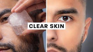 How To Get Clear Skin (Science Based)